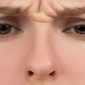 The Dangers of Botox Injections: An Expert's Perspective
