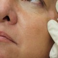 Which Botox Certification is Best for Medical Professionals?