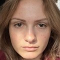 Can Botox Help Treat TMJ Disorder?