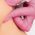What Happens to Muscles After Years of Botox Use?