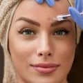 What Does Botox Do? A Comprehensive Guide