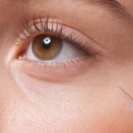 Is Botox Safe for Your Body?
