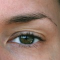 The Long-Term Effects of Botox: Is It Safe to Use Over Time?