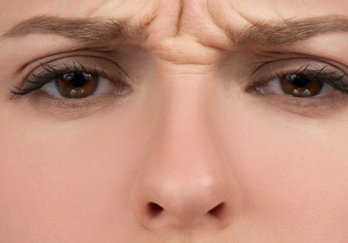 The Dangers of Botox Injections: An Expert's Perspective