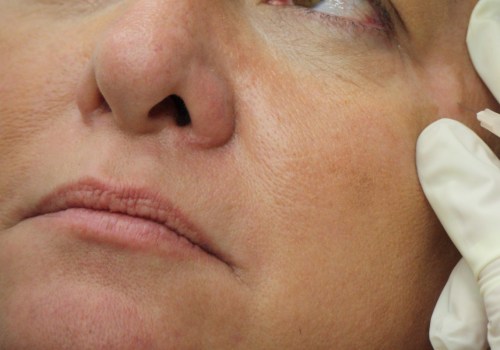 Which Botox Certification is Best for Medical Professionals?