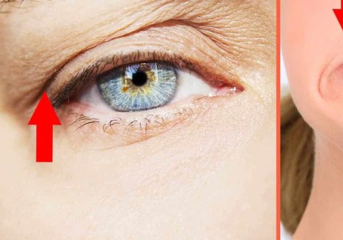 The Potential Negative Effects of Botox