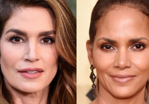 Does Botox Work for Everyone?