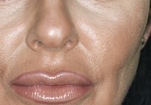 The Benefits of Botox: How It Can Change Your Face