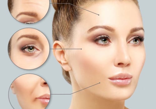 Where Does Botox Work Best on the Face?