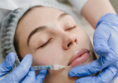 Skin Tightening, Botox and Lip Fillers by Skinsation LA: Premier Botox Treatments